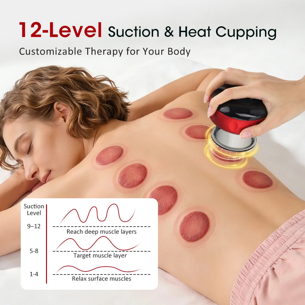 PASTSKY Rechargeable Smart Cupping Device With Adjustable Suction And Heat