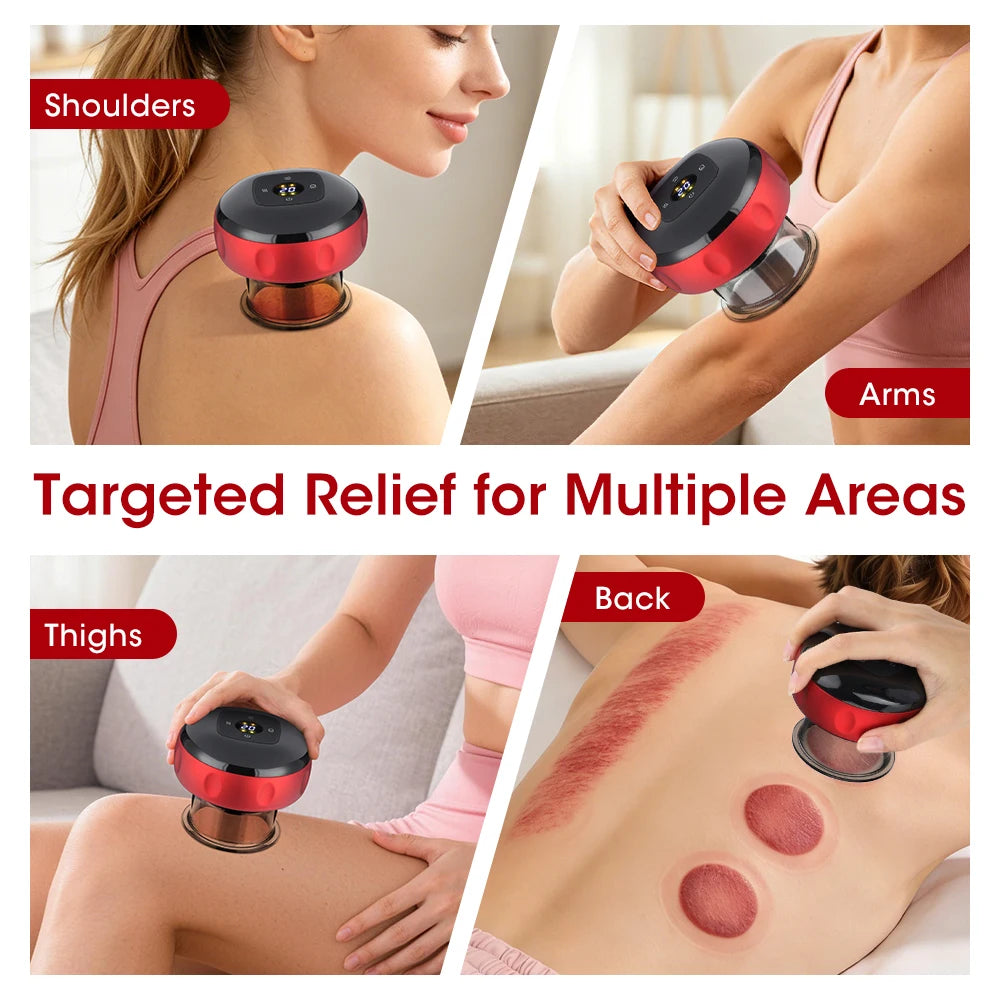 PASTSKY Rechargeable Smart Cupping Device With Adjustable Suction And Heat